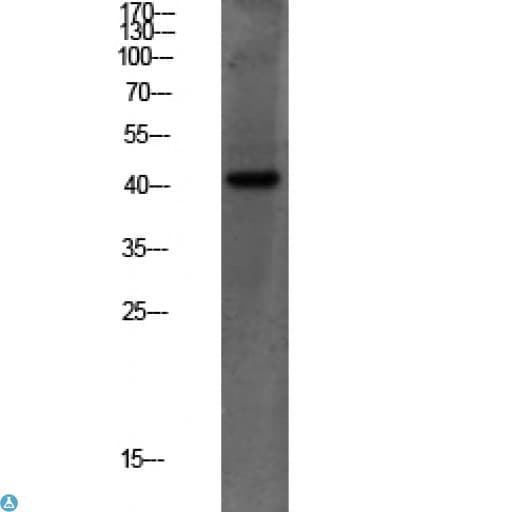 Polyclonal Rabbit anti-Human PEX14 Antibody (WB)