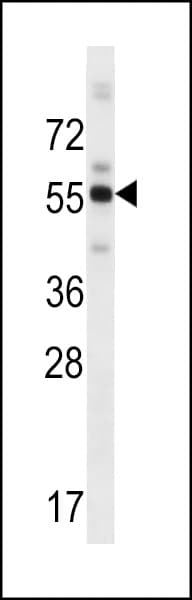 ZBTB8B Antibody (aa450-478)