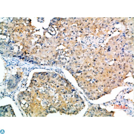 SOCS3 Antibody