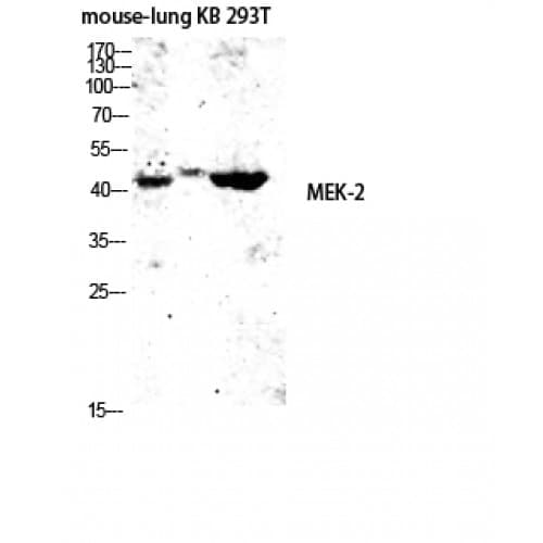 Polyclonal Rabbit anti-Human MAP2K2 / MKK2 / MEK2 Antibody (340-420 aa, IHC, WB)