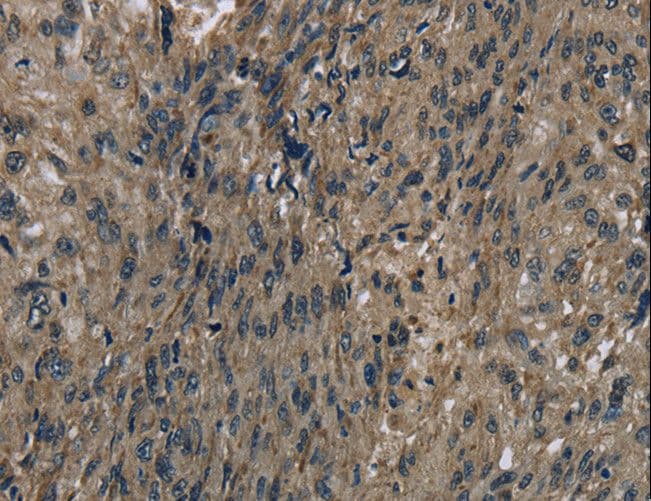 FTO Antibody