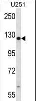 Polyclonal Rabbit anti-Human TTC13 Antibody (aa195-224, IHC, WB)