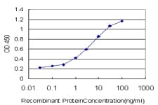 Monoclonal Mouse anti-Human KISS1 / Kisspeptin / Metastin Antibody (clone 1F7, WB)