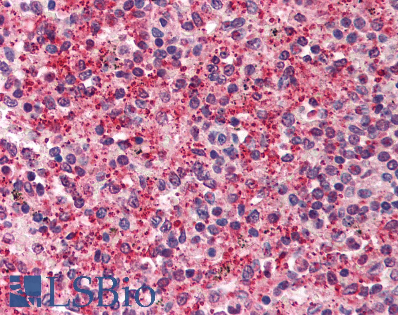 IHC-plus™ Raptor / Mip1 Antibody
