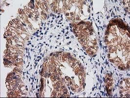 RASSF1 / RASSF1A Antibody (clone OTI2B11)