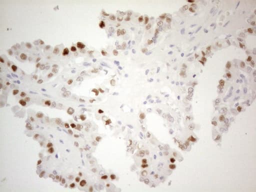 CDKN1A / WAF1 / p21 Antibody (aa2-164, clone OTI7C8)