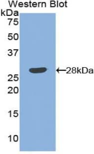 ANGPT1 / Angiopoietin-1 Antibody (aa266-497, PE)