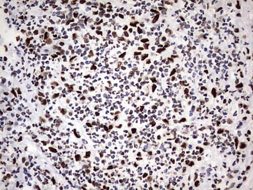 HNRPM / HNRNPM Antibody (aa1-261, clone OTI4C9)