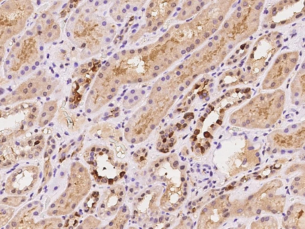 ZNF558 Antibody