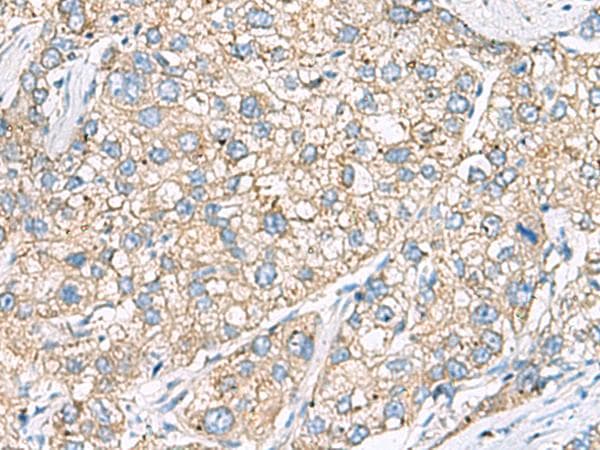 Polyclonal Rabbit anti-Human SHC3 / SHCC Antibody (IHC, WB)