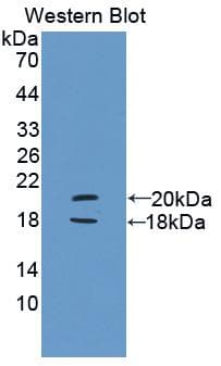PYGL Antibody (aa603-750)