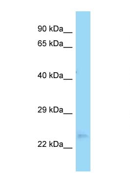 OVCA2 Antibody (aa106-155)