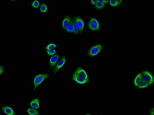 PANK2 Antibody
