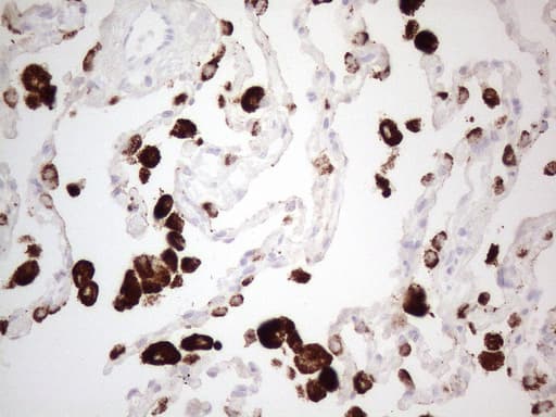 NAPSA / NAPA / Napsin A Antibody (aa64-244, clone OTI2F11)