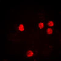 Histone H2B Antibody (Acetyl-Lys12)