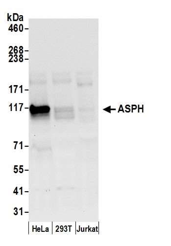 Junctin / ASPH Antibody (aa300-350)