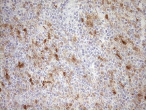 p16INK4a / CDKN2A Antibody (clone OTI3G3)