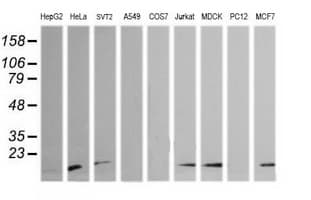 HRAS / H-Ras Antibody (clone OTI2A1)