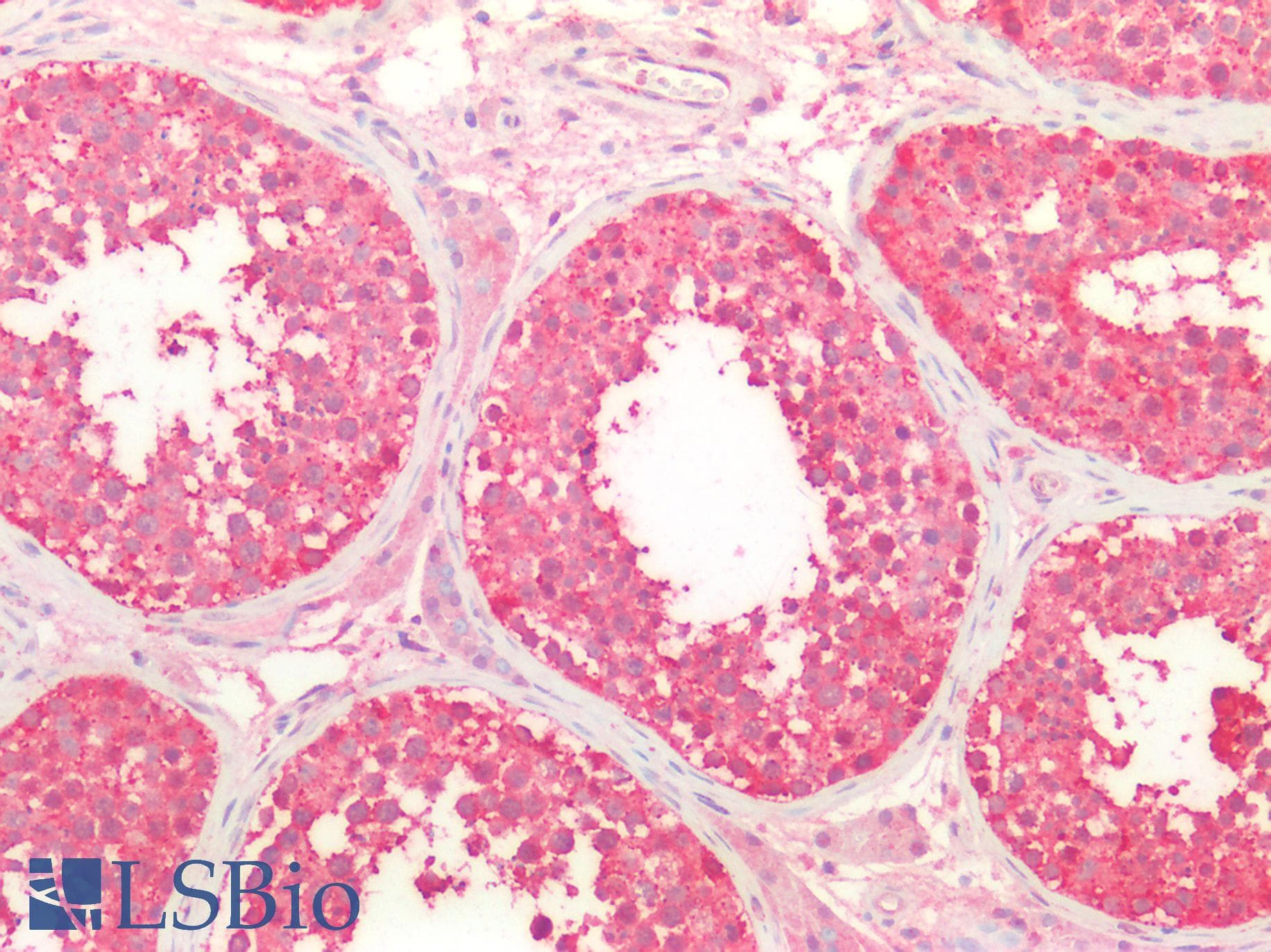 SLC27A1 / FATP Antibody (aa191-475)