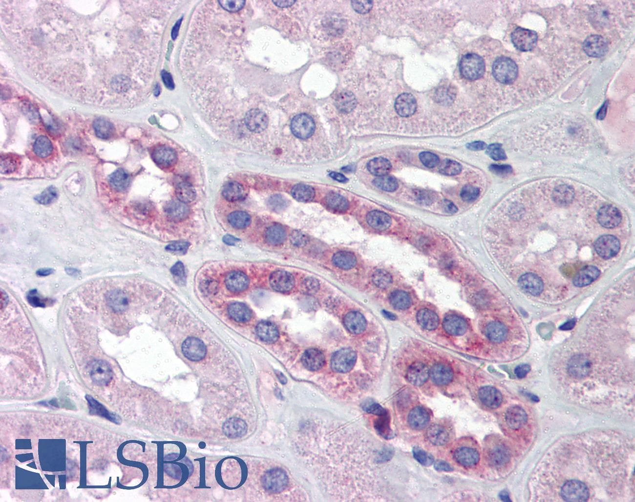 IHC-plus™ HIF1A / HIF1 Alpha Antibody (aa432-528)