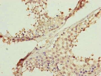 Polyclonal Rabbit anti-Human FBXL5 / FBL5 Antibody (IHC)