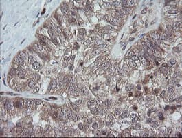TRAPPC4 / Synbindin Antibody (clone OTI2E1)