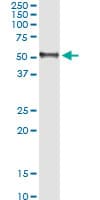 HAVCR1 / KIM-1 Antibody (clone 2G11)