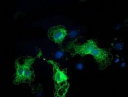PRKCE / PKC-Epsilon Antibody (clone OTI2E9)