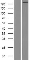 RREB1 Protein (Over-Expression Lysate Myc-DDK (Flag))