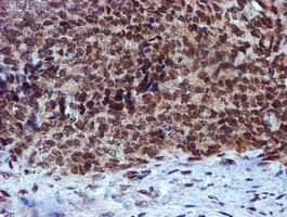 Monoclonal Mouse anti-Human RFXANK Antibody (clone OTI2B6, IHC, IF, WB)