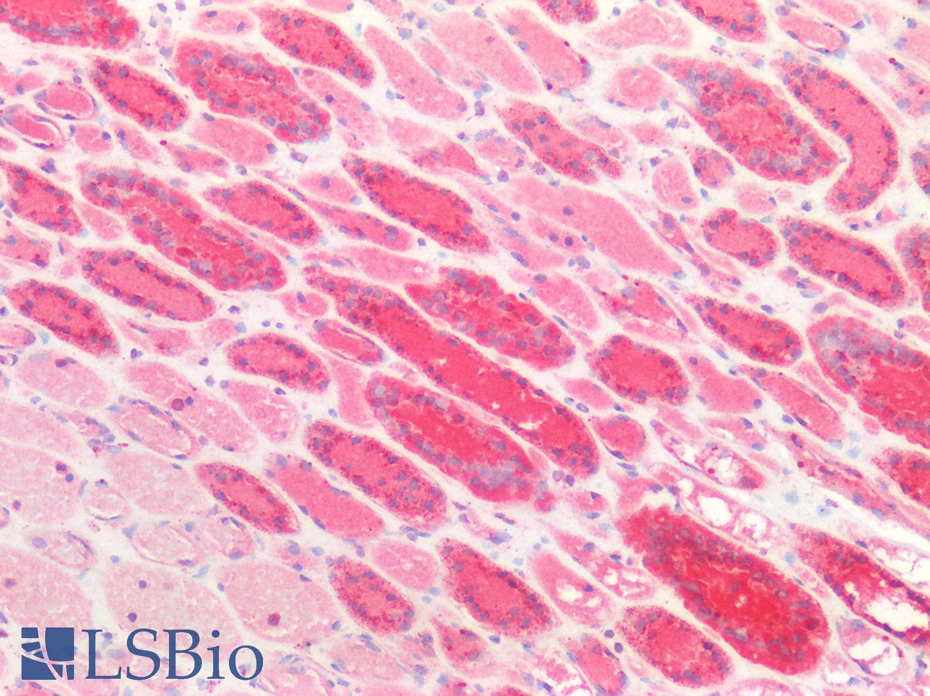 PathPlus™ Polyclonal Rabbit anti-Human CTSD / Cathepsin D Antibody (aa72-292, IHC, WB)
