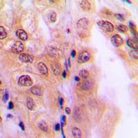 PPP2R5D Antibody (C-Terminus)