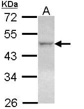 NR1H2 / LXR Beta Antibody