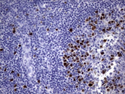 TOP2A / Topoisomerase II Alpha Antibody (aa1100-1531, clone UMAB146)