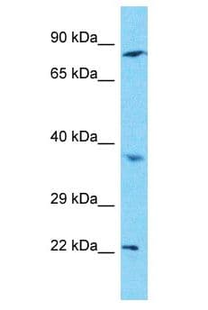 C1orf105 Antibody (aa126-175)