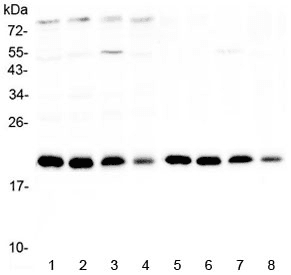 NIP3 / BNIP3 Antibody