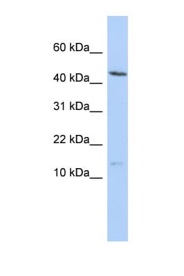 MYL6 Antibody (N-Terminus)