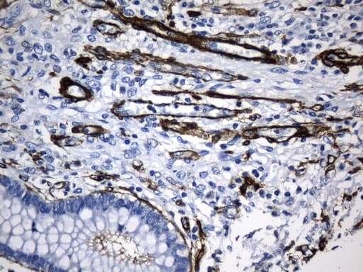ACTA2 / Smooth Muscle Actin Antibody (N-Terminus, clone UMAB237)
