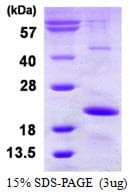 Human HSPB9 Protein (Recombinant His)