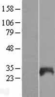 SNX21 Protein (Over-Expression Lysate Myc-DDK (Flag))