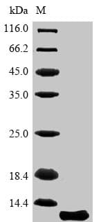 Mouse AQP4 / Aquaporin 4 Protein (Recombinant 6His, N-terminus)