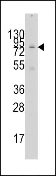 KAT2A / GCN5 Antibody (aa65-94)