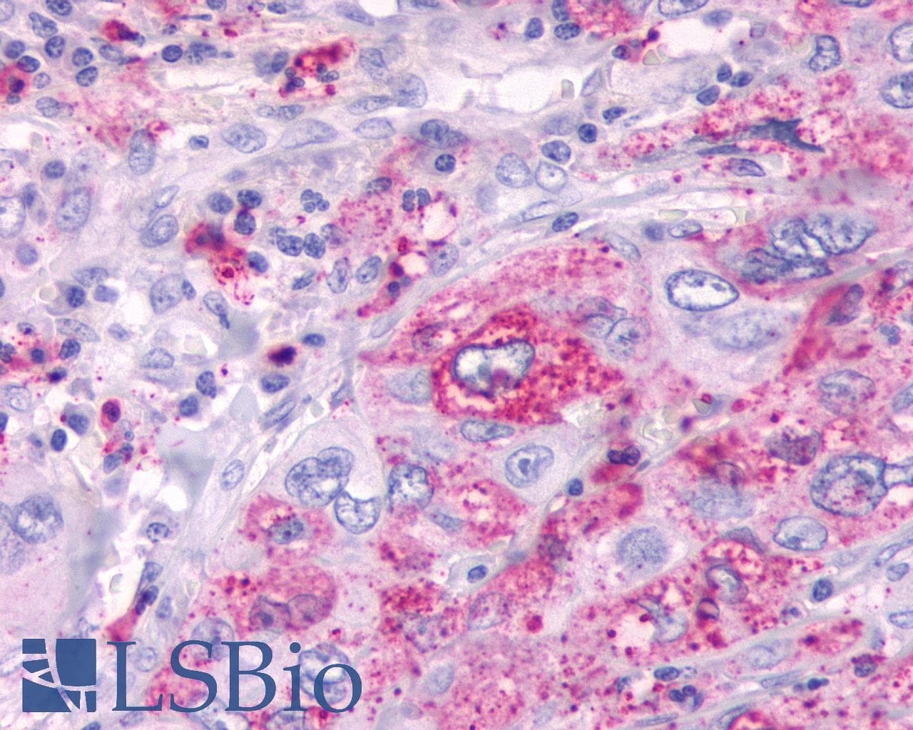 PathPlus™ Polyclonal Rabbit anti-Human GPR61 Antibody (C-Terminus, IHC)