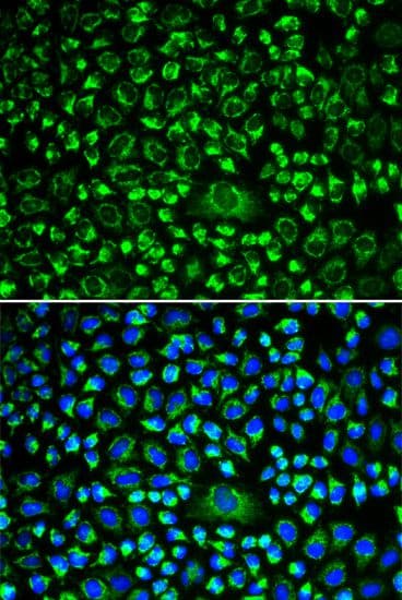 TAPBP / Tapasin Antibody