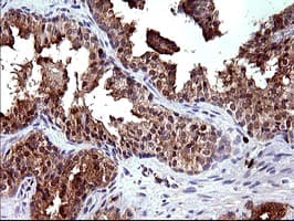 Monoclonal Mouse anti-Human PLA2G16 / HRASLS3 Antibody (clone OTI1A5, IHC, IF, WB)