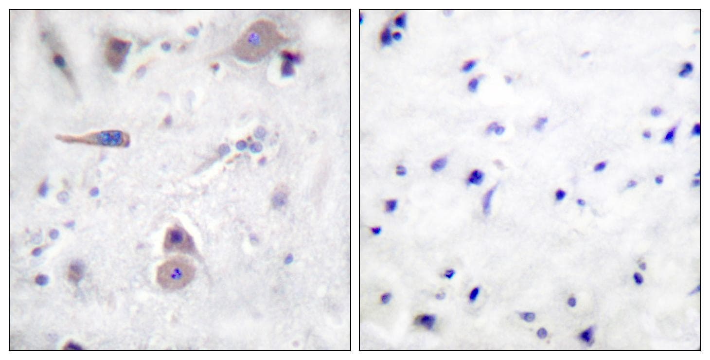 Polyclonal Rabbit anti-Human APP / Beta Amyloid Precursor Antibody (phospho-Thr743/668, IHC, IF, WB)