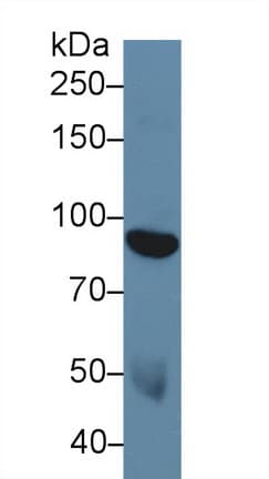 NEP / DDR1 Antibody (aa568-829)