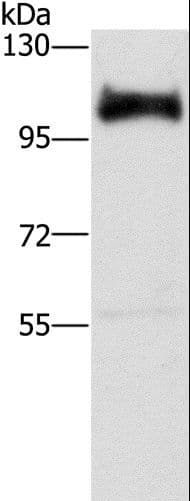 DAB2 Antibody