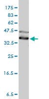 IHC-plus™ Monoclonal Mouse anti-Human DNAJA4 Antibody (clone 4B4-1F2, IHC, IF, WB)