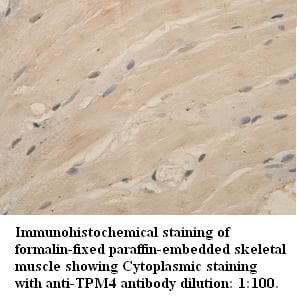TPM4 Antibody (N-Terminus)